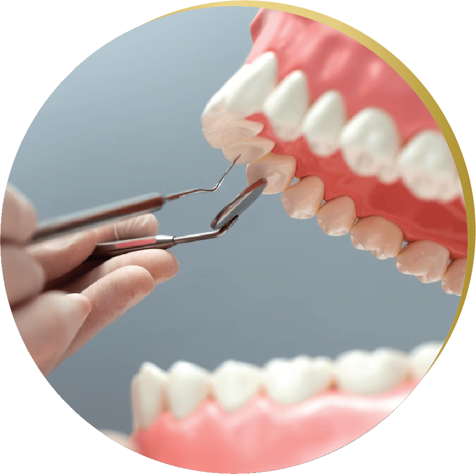 Close-up of dental model with tools – A dentist demonstrating the structure of dental implants on a model.