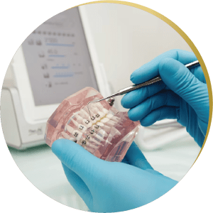 Gloved hands adjusting a dental model with braces – Demonstrating how inlays & onlays can restore damaged teeth alongside orthodontics.